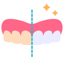 Tooth Whitening