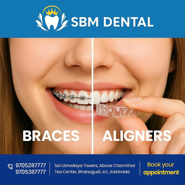ALIGNERS vs BRACES Which is Better for Overbite Correction