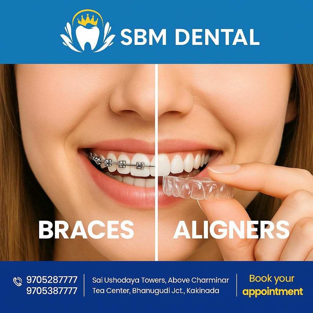 ALIGNERS vs BRACES Which is Better for Overbite Correction