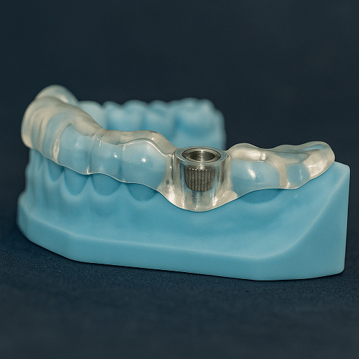 guided implant surgery in kakinada