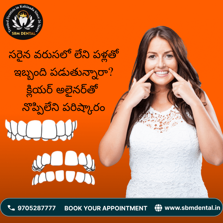 సరైన వరుసలో లేని పళ్లతో ఇబ్బంది పడుతున్నారా క్లియర్ అలైనర్‌తో నొప్పిలేని పరిష్కారం (2)
