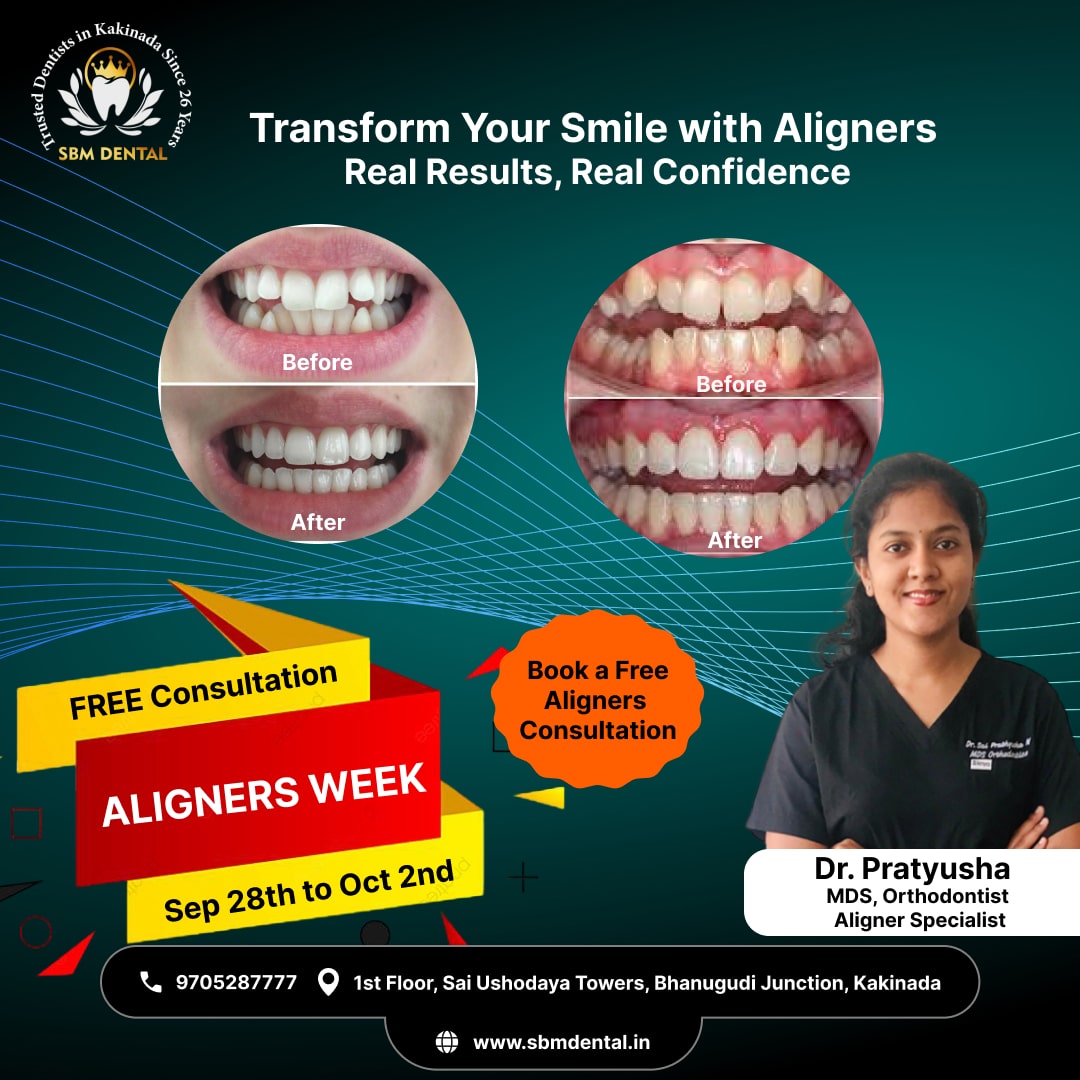 aligner week sbm dental kakinada