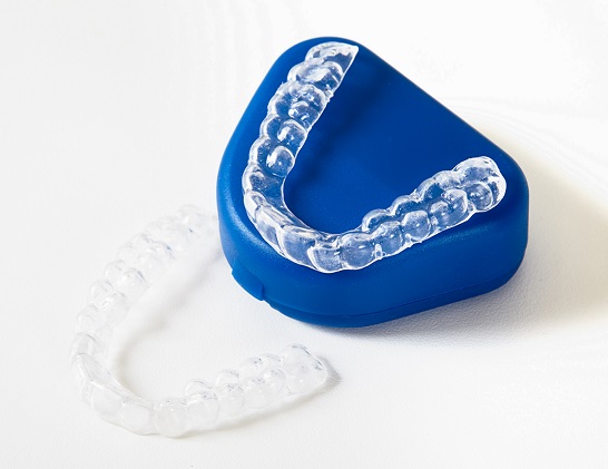 aligners treatment in kakinada