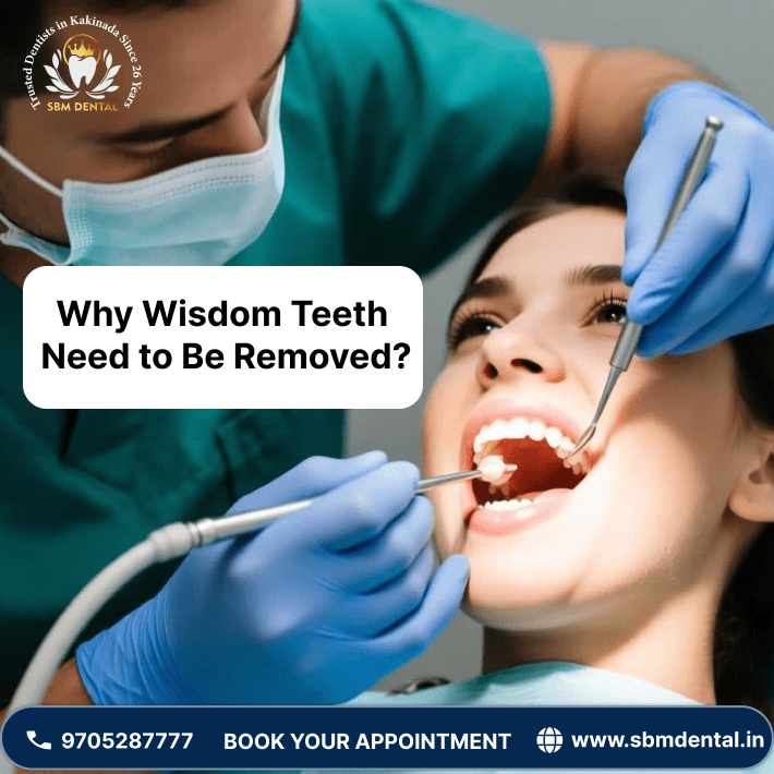 Why Wisdom Teeth Need to Be Removed