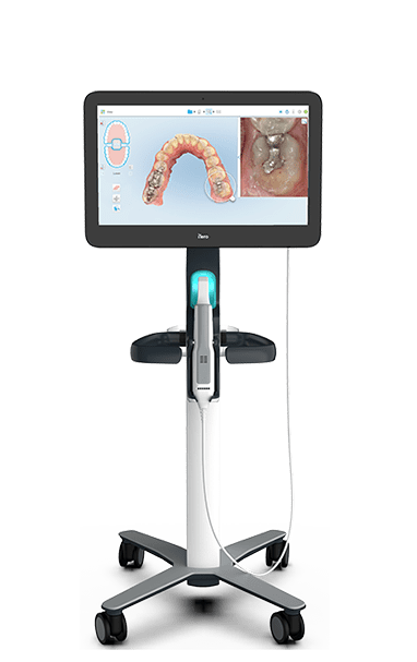 itero 3d scan at sbm dental kakinada