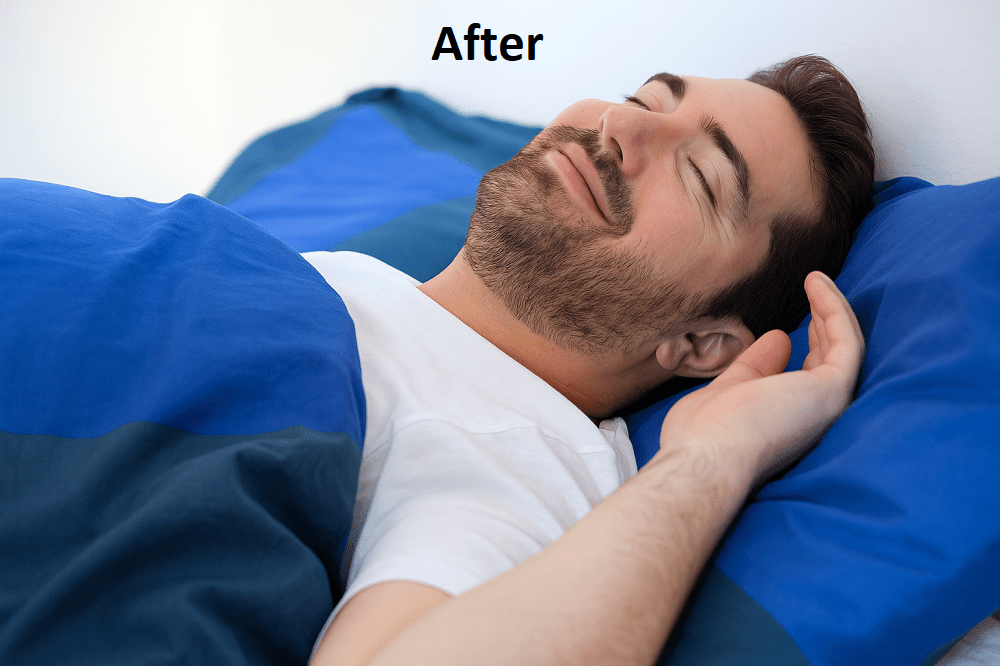 sleep apnea after treatment