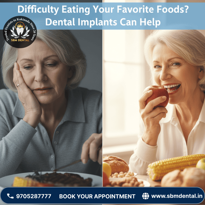 Difficulty Eating Your Favorite Foods? Dental Implants Can Help
