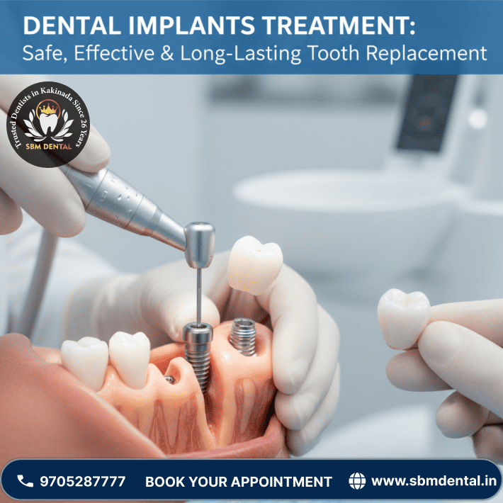 Dental Implants Treatment Safe, Effective & Long-Lasting Tooth Replacement