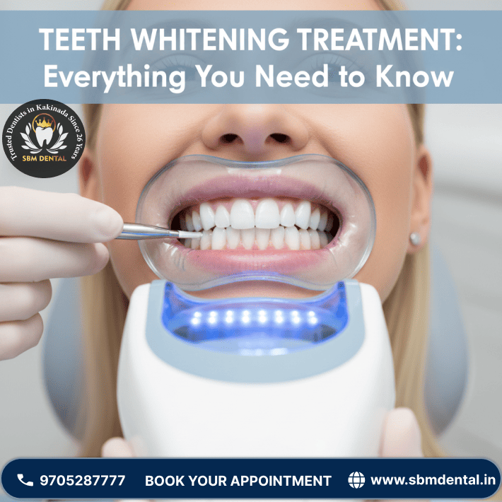Teeth Whitening Treatment Everything You Need to Know