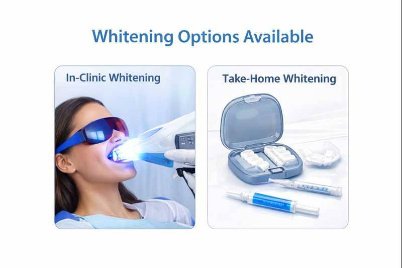 Whitening Options Available