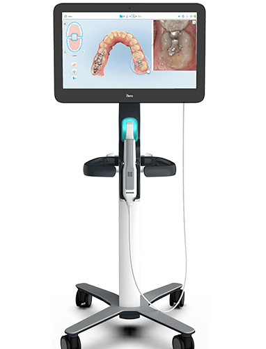 itero-3d-scan-at-sbm-dental-kakinada