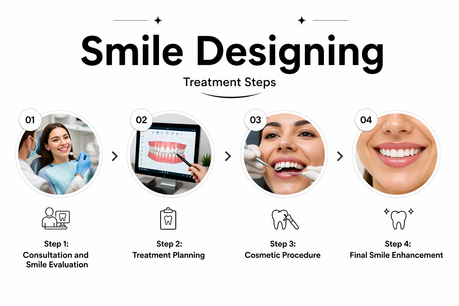 Smile Designing Treatment Steps