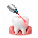 laser-dentistry