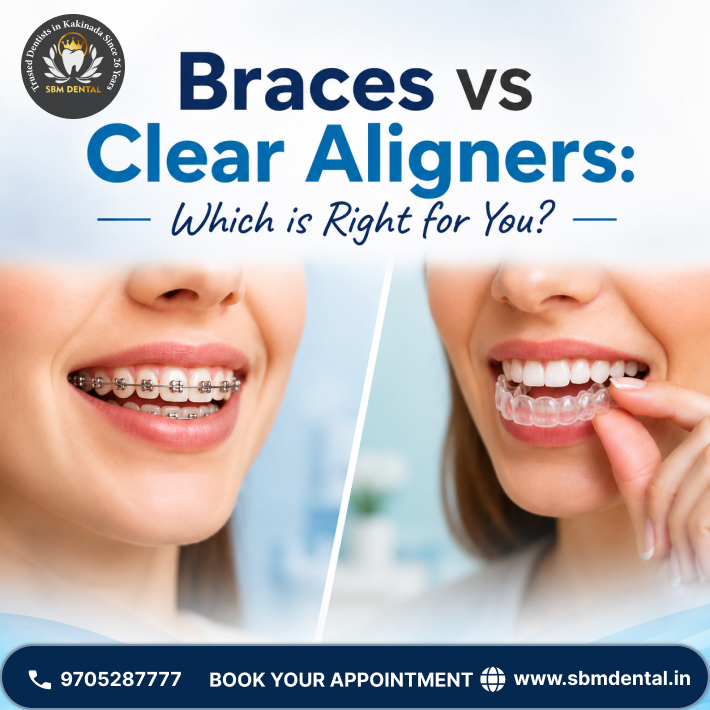 Braces vs Clear Aligners: Which is Right for You?