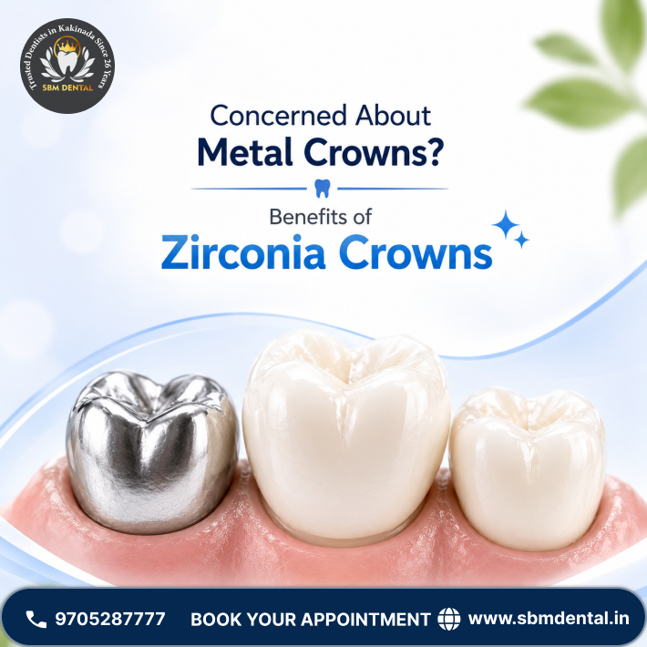 Concerned About Metal Crowns? Benefits of Zirconia Crowns